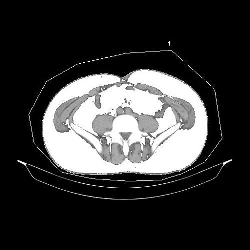 久津川医師の腹部CT図
